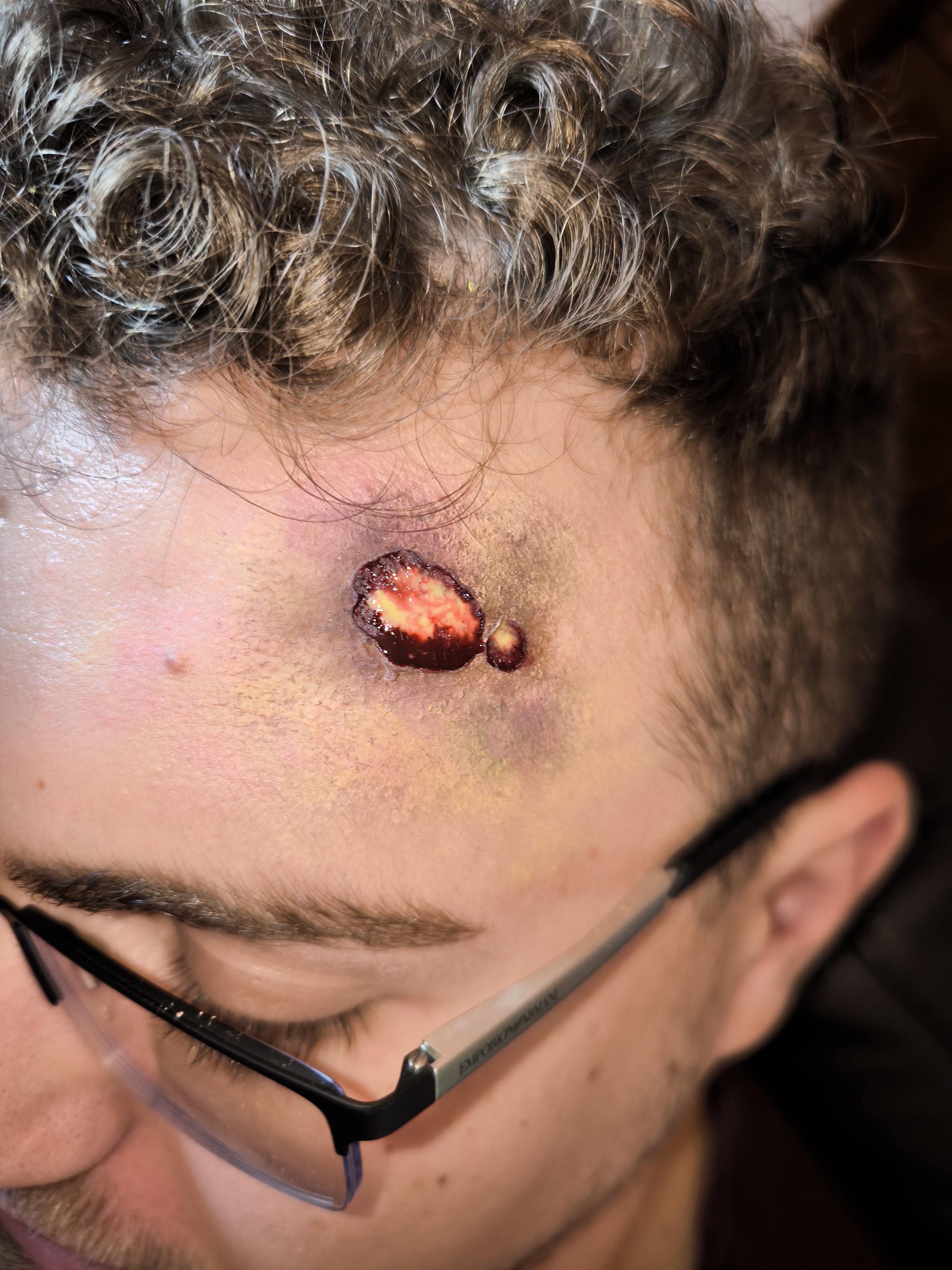 Prótesis de herida simulada con textura y profundidad realista