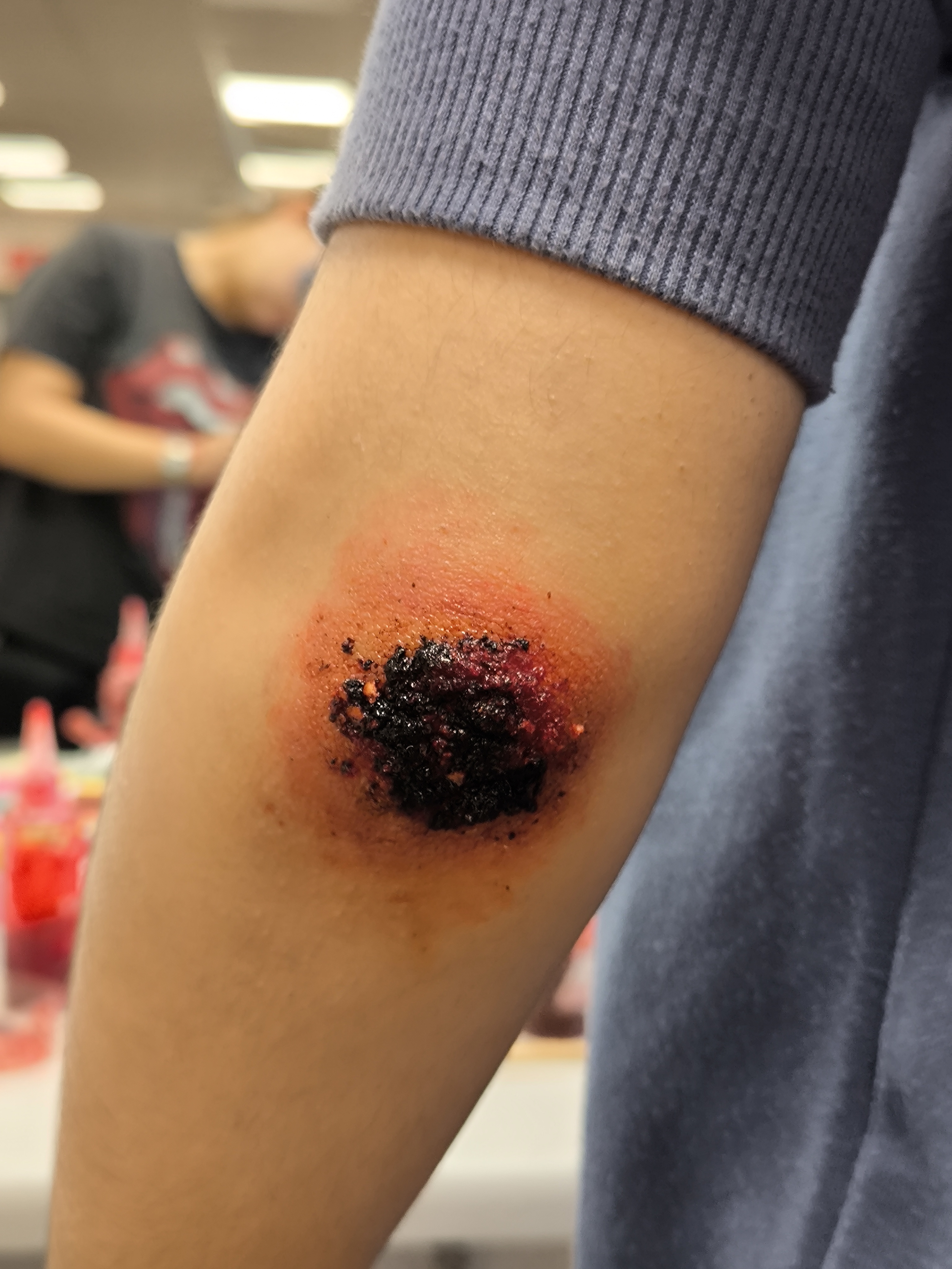 Simulación de herida con efecto inflamado y centro oscuro