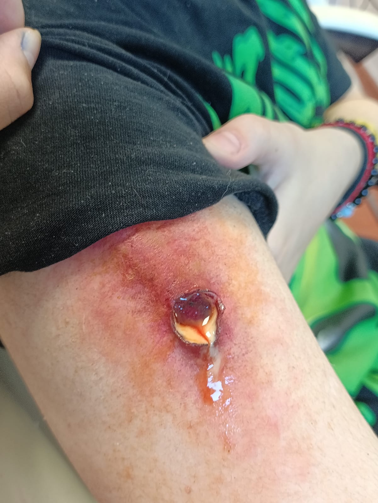 Proceso de creación de herida con materiales de FX