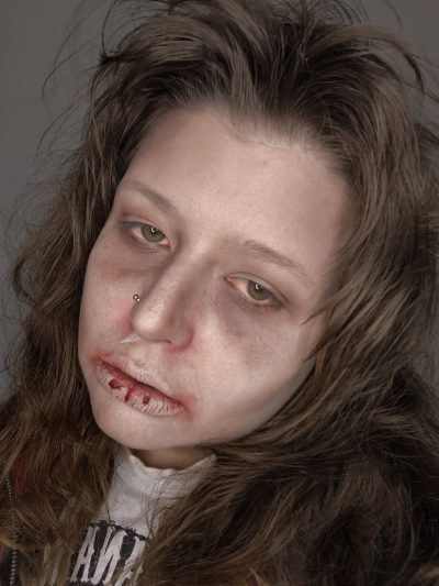 Primer plano de maquillaje FX con palidez, ojeras oscuras, rojeces alrededor de ojos y nariz y heridas simuladas en los labios.