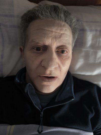Fenómenos cadavéricos FX: simulación de livideces y palidez cadavérica