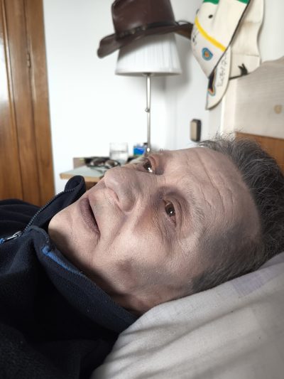 Fenómenos cadavéricos FX: vista lateral del efecto cadavérico completo