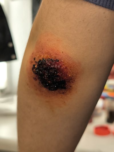 Rozadura realista FX: simulación de abrasión cutánea con eritema y pérdida de epidermis